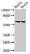 Copine 4 antibody, CSB-PA850253LA01HU, Cusabio, Western Blot image 