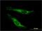 Lanosterol Synthase antibody, H00004047-M01, Novus Biologicals, Immunocytochemistry image 