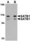 SATB Homeobox 1 antibody, TA306604, Origene, Western Blot image 