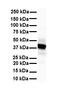 Solute Carrier Family 6 Member 2 antibody, orb325098, Biorbyt, Western Blot image 