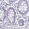 MORC Family CW-Type Zinc Finger 4 antibody, PA5-51379, Invitrogen Antibodies, Immunohistochemistry paraffin image 
