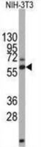 Dihydropyrimidinase Like 2 antibody, NBP1-50580, Novus Biologicals, Western Blot image 