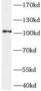 ACTN4 antibody, FNab00123, FineTest, Western Blot image 