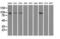Hexokinase 2 antibody, GTX84357, GeneTex, Western Blot image 