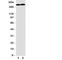 Tenascin C antibody, R31166, NSJ Bioreagents, Western Blot image 