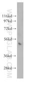 NFKB Inhibitor Epsilon antibody, 11273-1-AP, Proteintech Group, Western Blot image 
