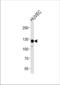 Protein Tyrosine Kinase 2 antibody, TA328127, Origene, Western Blot image 