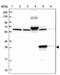 Enoyl-CoA Hydratase Domain Containing 3 antibody, PA5-58332, Invitrogen Antibodies, Western Blot image 