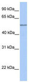 SPEM Family Member 2 antibody, TA337556, Origene, Western Blot image 