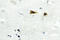 ABL Proto-Oncogene 1, Non-Receptor Tyrosine Kinase antibody, LS-C177032, Lifespan Biosciences, Immunohistochemistry frozen image 