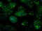 Isocitrate Dehydrogenase (NAD(+)) 3 Alpha antibody, M09544, Boster Biological Technology, Immunofluorescence image 