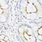 C-C Motif Chemokine Ligand 22 antibody, A02020, Boster Biological Technology, Immunohistochemistry paraffin image 