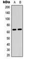 Dihydropyrimidinase Like 2 antibody, LS-C356002, Lifespan Biosciences, Western Blot image 
