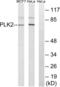 SNK antibody, LS-B9872, Lifespan Biosciences, Western Blot image 