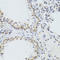 Aly/REF Export Factor antibody, A03580, Boster Biological Technology, Immunohistochemistry frozen image 