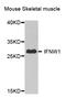 Interferon Omega 1 antibody, STJ110424, St John