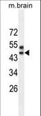 Sprouty Related EVH1 Domain Containing 3 antibody, LS-C161471, Lifespan Biosciences, Western Blot image 