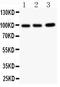Erythrocyte Membrane Protein Band 4.1 Like 1 antibody, LS-C344030, Lifespan Biosciences, Western Blot image 