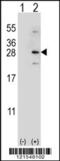 NADH dehydrogenase [ubiquinone] iron-sulfur protein 4, mitochondrial antibody, 62-547, ProSci, Western Blot image 