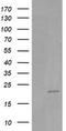 HRas Proto-Oncogene, GTPase antibody, TA505676S, Origene, Western Blot image 