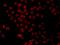 Protein transport protein Sec61 subunit alpha isoform 1 antibody, orb326528, Biorbyt, Immunocytochemistry image 