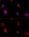 Polypyrimidine Tract Binding Protein 1 antibody, GTX54619, GeneTex, Immunofluorescence image 