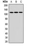 NLR Family CARD Domain Containing 4 antibody, LS-B15835, Lifespan Biosciences, Western Blot image 