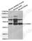 Acetylcholine receptor subunit beta antibody, A5295, ABclonal Technology, Western Blot image 