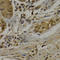 Uridine Monophosphate Synthetase antibody, A5492, ABclonal Technology, Immunohistochemistry paraffin image 