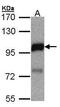 DLC1 Rho GTPase Activating Protein antibody, GTX106392, GeneTex, Western Blot image 