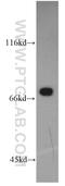 Plastin 1 antibody, 55212-1-AP, Proteintech Group, Western Blot image 