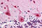 Fanconi anemia group A protein antibody, MBS240226, MyBioSource, Immunohistochemistry frozen image 