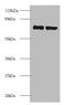 Ribosomal Protein S10 antibody, A52736-100, Epigentek, Western Blot image 