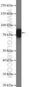 Epithelial splicing regulatory protein 1 antibody, 21045-1-AP, Proteintech Group, Western Blot image 