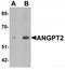 Angiopoietin 2 antibody, TA319610, Origene, Western Blot image 