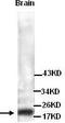 Troponin I2, Fast Skeletal Type antibody, TA310134, Origene, Western Blot image 