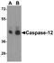 Caspase-12 antibody, NBP1-76624, Novus Biologicals, Western Blot image 