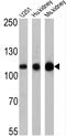 ATPase Na+/K+ Transporting Subunit Alpha 4 antibody, MA3-928, Invitrogen Antibodies, Western Blot image 