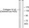 Collagen Type IV Alpha 3 Chain antibody, TA313650, Origene, Western Blot image 