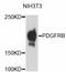Platelet Derived Growth Factor Receptor Beta antibody, STJ112932, St John