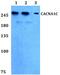 Voltage-dependent L-type calcium channel subunit alpha-1C antibody, A00976-1, Boster Biological Technology, Western Blot image 