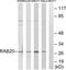 RAB20, Member RAS Oncogene Family antibody, TA312698, Origene, Western Blot image 
