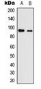 Neuroligin 3 antibody, LS-C354443, Lifespan Biosciences, Western Blot image 