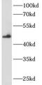 Ankyrin Repeat Domain 33 antibody, FNab00412, FineTest, Western Blot image 