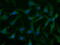 Uridine-cytidine kinase 1 antibody, GTX83442, GeneTex, Immunofluorescence image 