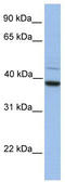 FKBP Prolyl Isomerase 8 antibody, TA341899, Origene, Western Blot image 