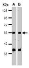 G Protein Pathway Suppressor 1 antibody, GTX100291, GeneTex, Western Blot image 