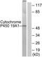 Cytochrome P450 Family 19 Subfamily A Member 1 antibody, TA311724, Origene, Western Blot image 