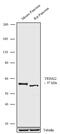 E3 ubiquitin-protein ligase TRIM22 antibody, 720263, Invitrogen Antibodies, Western Blot image 
