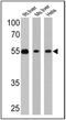 LXR beta antibody, NB100-74457, Novus Biologicals, Western Blot image 